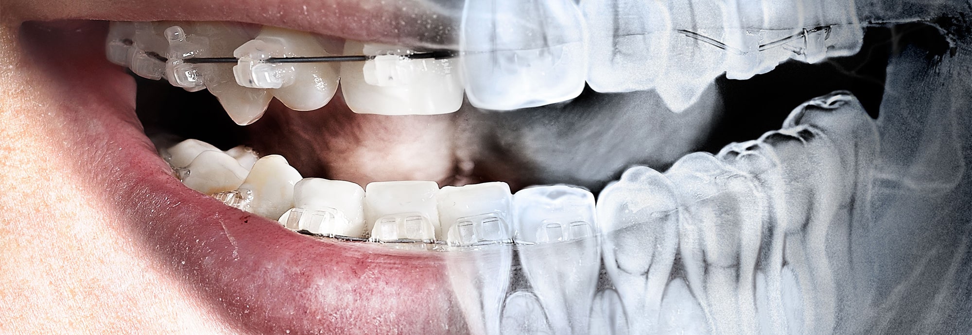 رادیولوژی دهان و دندان