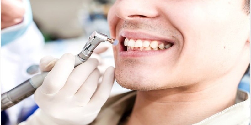 فواید جرمگیری و بروساژ دندان چیست ؟