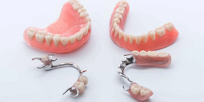 مزایا و معایب دندان مصنوعی