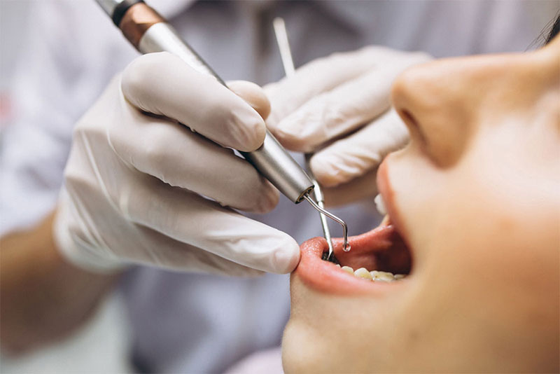 درمان های کلینیکی دندان درد چگونه است؟