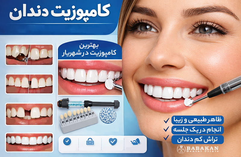 بهترین دکتر کامپوزیت در شهریار