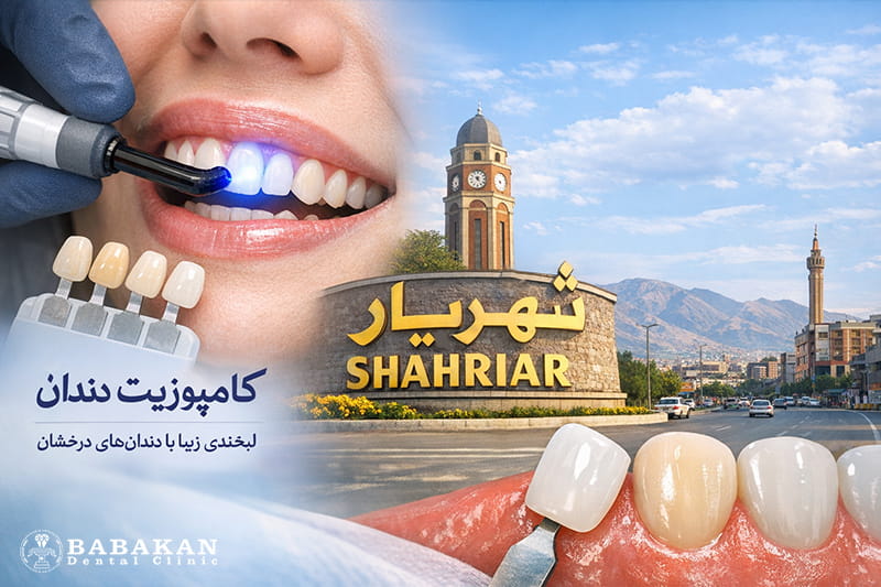 دکتر کامپوزیت دندان در شهریار