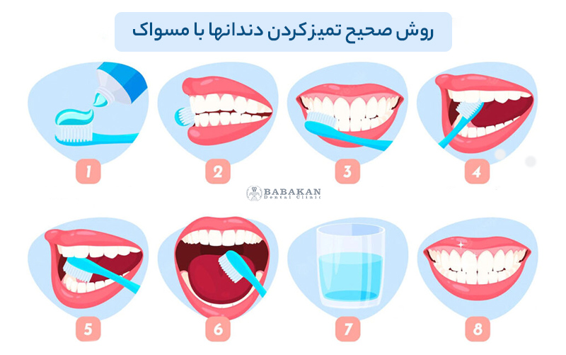 روش صحیح مسواک زدن