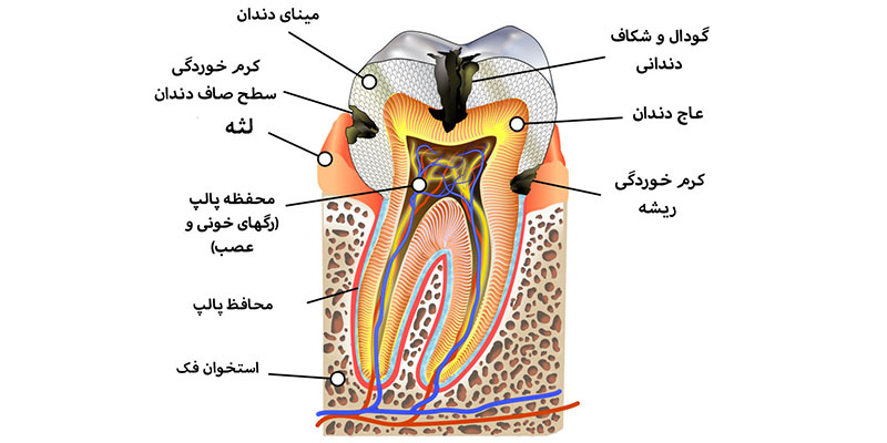 دلایل حساسیت دندان