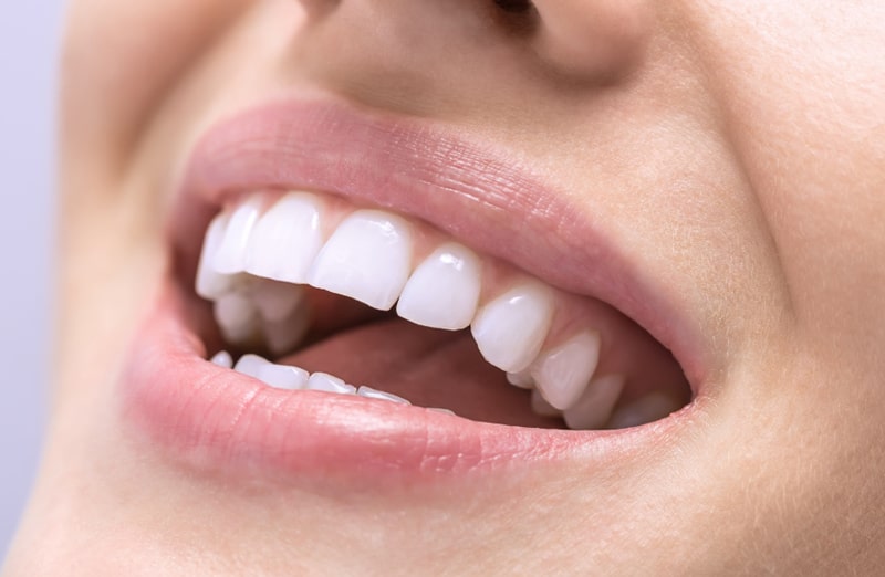 بهترین مارک کامپوزیت دندان