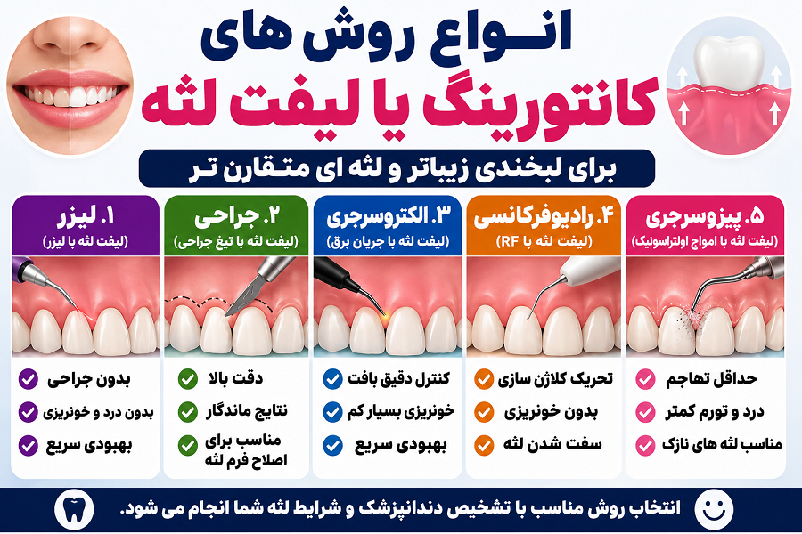 روش های لیفت یا کانتورینگ لثه