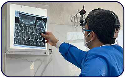 معاینه و مشاهده عکس دندان برای کاشت ایمپلنت توسط متخصص ایمپلنت شهریار
