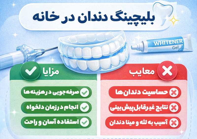هوم بلیچینگ دندان در خانه
