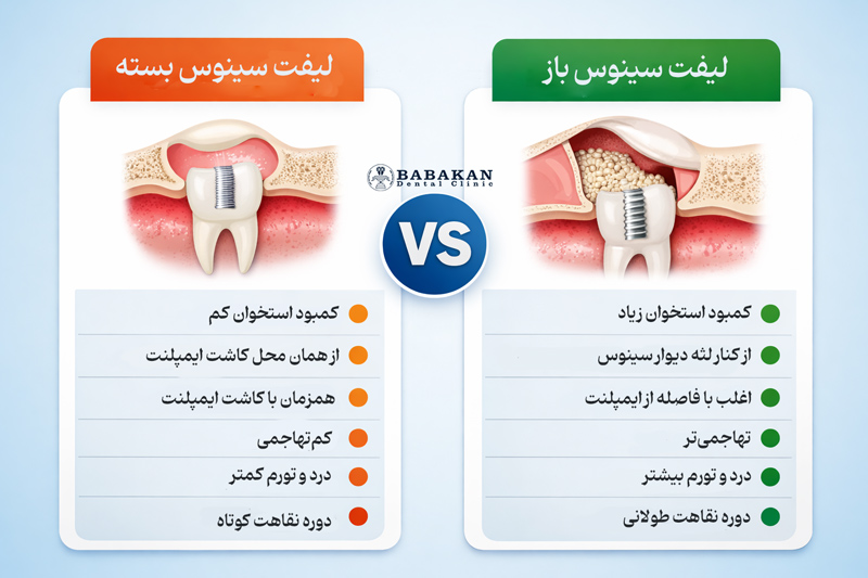 تفاوت عمل لیفت سینوس باز و بسته