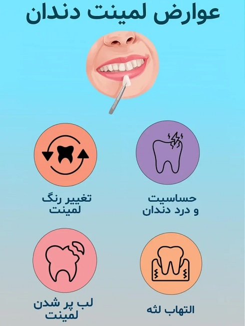 عوارض لمینت دندان