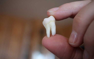 کشیدن دندان بدون درد