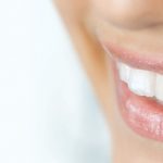 دلایل تغییر رنگ بعد از عصب کشی دندانها