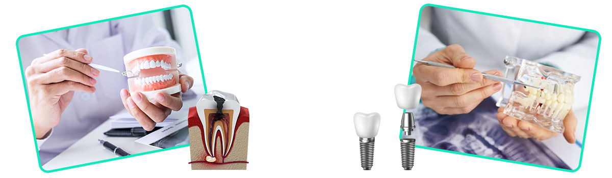 تفاوت متخصص ایمپلنت و دندانپزشک چیست
