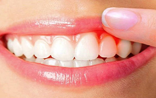 عوارض عفونت دندان