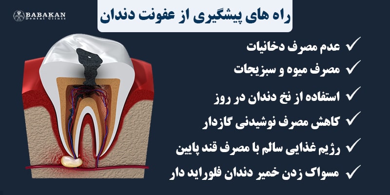 راه های پیشگیری از عفونت دندان