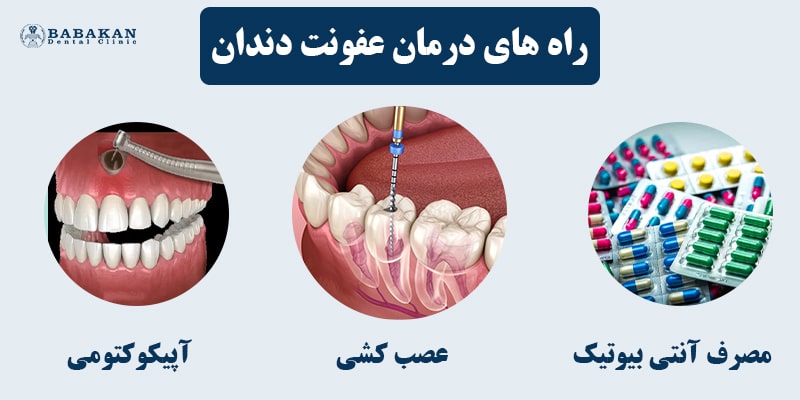 چگونه عفونت دندان را خارج کنیم
