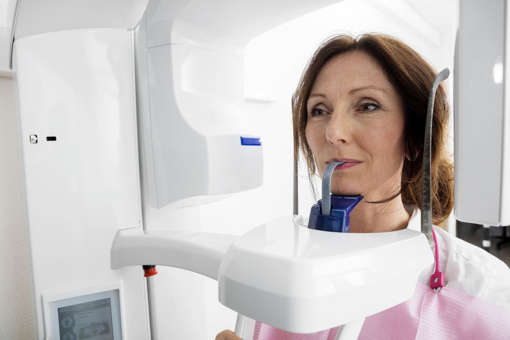 تصویربرداری سی بی سی تی cbct