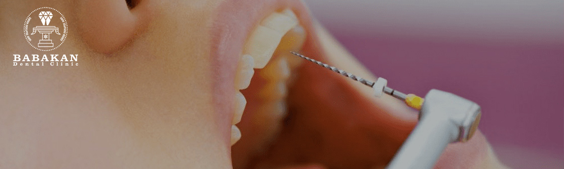 عوارض احتمالی بعد از عصب کشی دندان