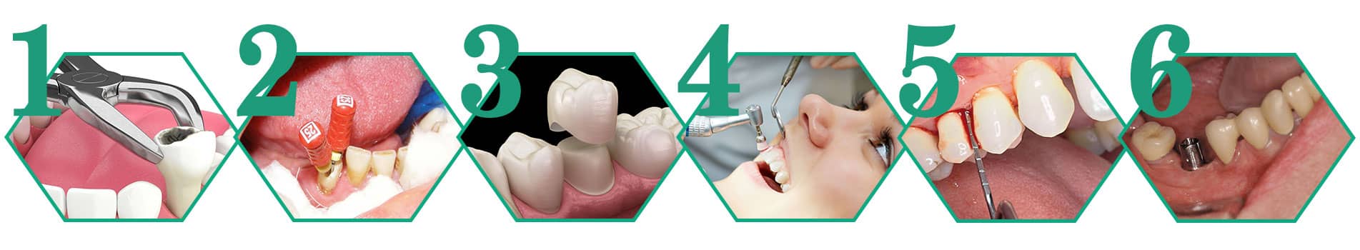 ترتیب طرح درمان دندانپزشکی