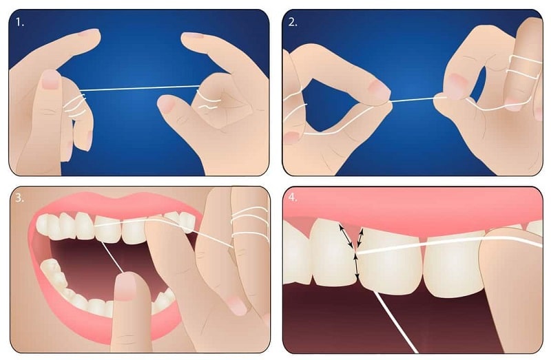 اهمیت و نحوه استفاده از نخ دندان