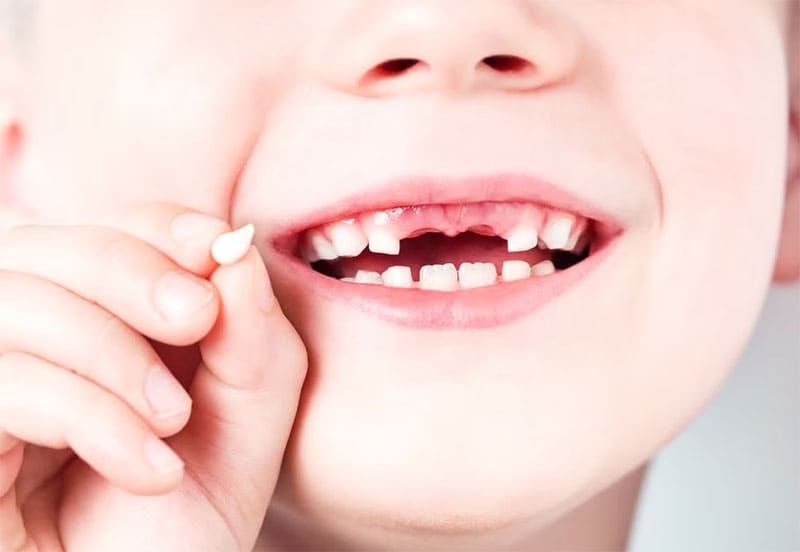  چه اتفاقی در اثر ضربه به دندان کودک رخ می دهد؟