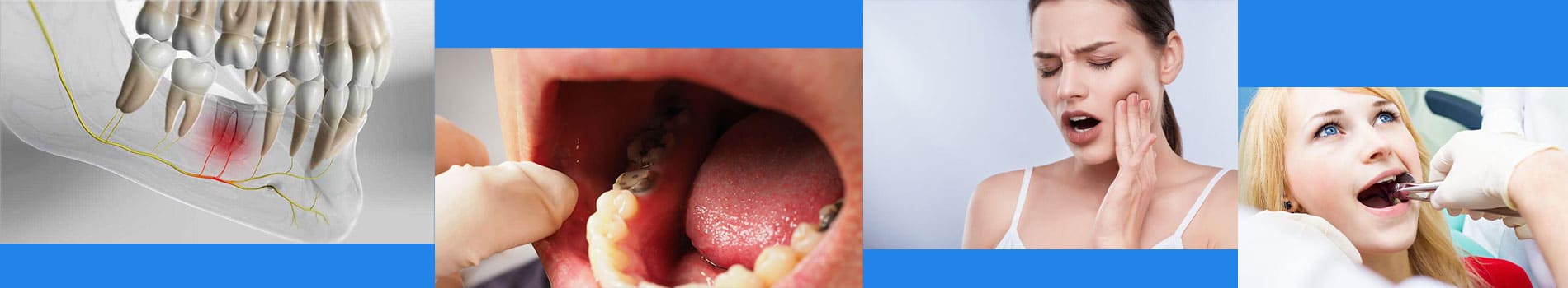 حفره خشک دندان چیست؟