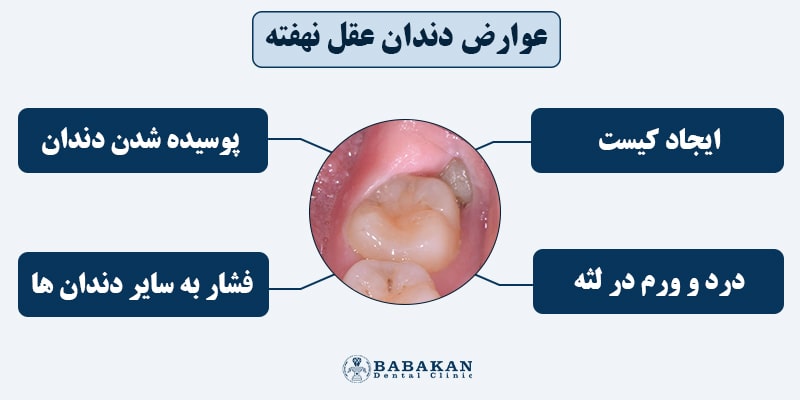 عوارض دندان عقل نهفته