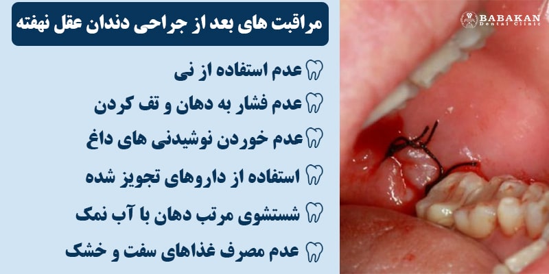 مراقبت های بعد از جراحی دندان عقل نهفته