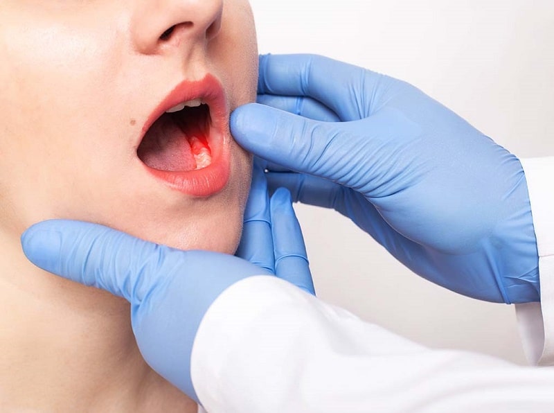 خطاهای رایج بیماران که باعث تشدید خونریزی میشود