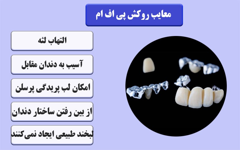 معایب روکش پی اف ام