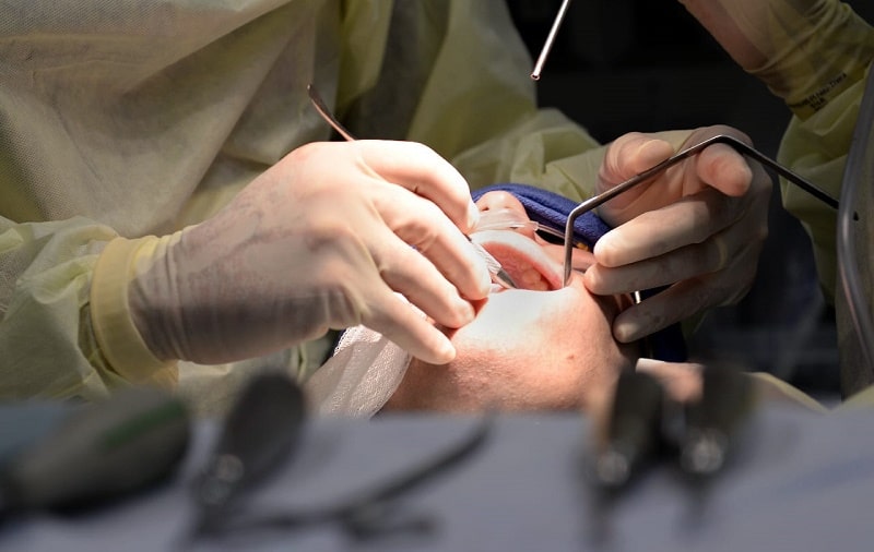 مراحل انجام جراحی لثه پیش از کاشت ایمپلنت