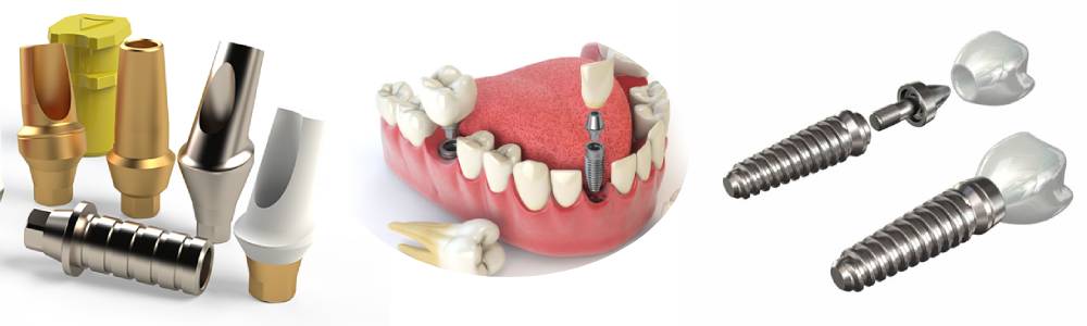 عکس شاخص ایمپلنت نئودنت