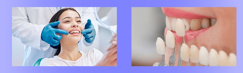 تعویض روکش دندان