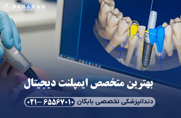 بهترین مرکز ایمپلنت دیجیتال در شهریار و اندیشه