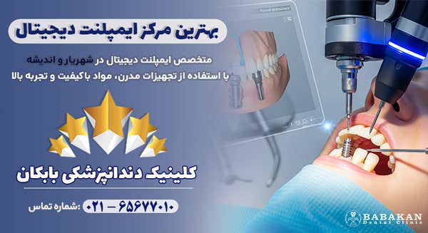 بهترین متخصص ایمپلنت دیجیتال در شهریار و اندیشه