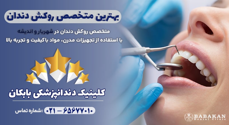 بهترین متخصص روکش دندان در شهریار و اندیشه