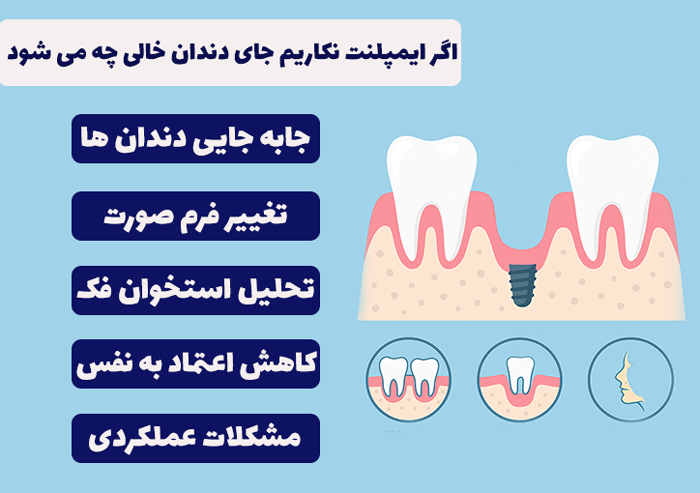 اگر ایمپلنت نکنیم چه میشود