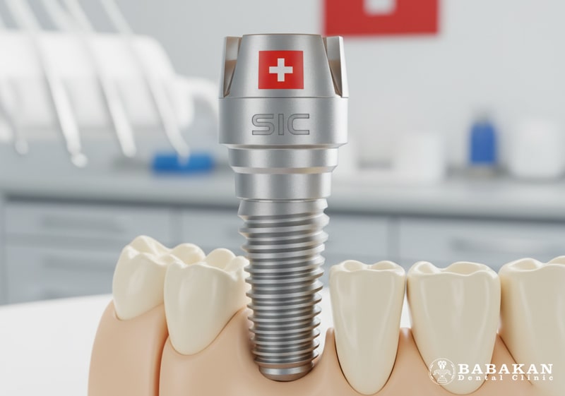 ایمپلنت sic سوئیسی