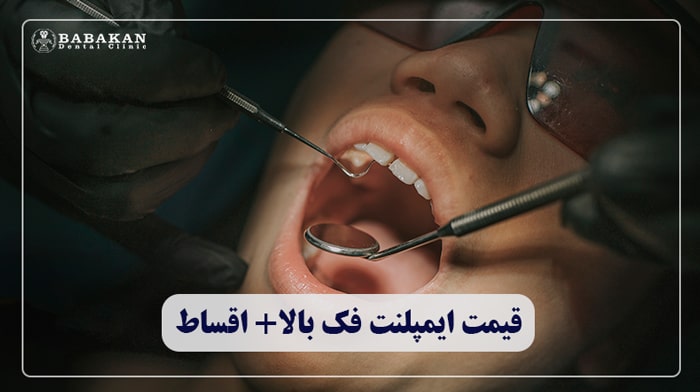 قیمت ایمپلنت فک بالا