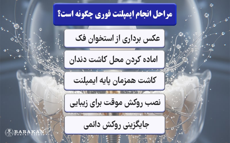مراحل ایمپلنت فوری چگونه است