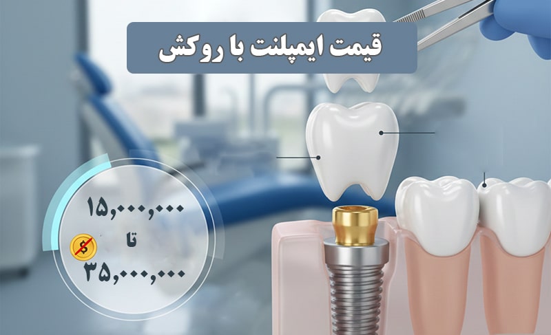 قیمت ایمپلنت با روکش