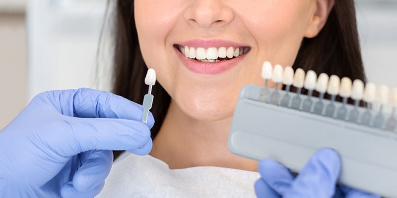 لمینت دندان در شهریار