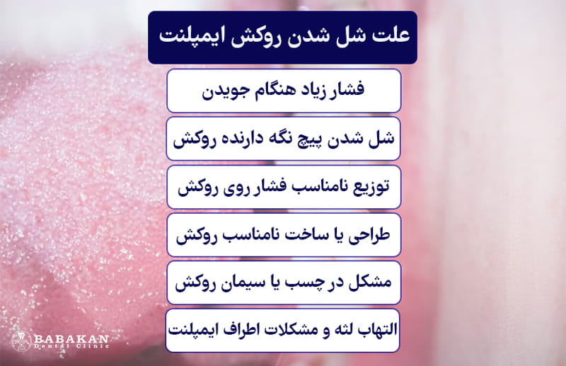 علت شل شدن روکش ایمپلنت