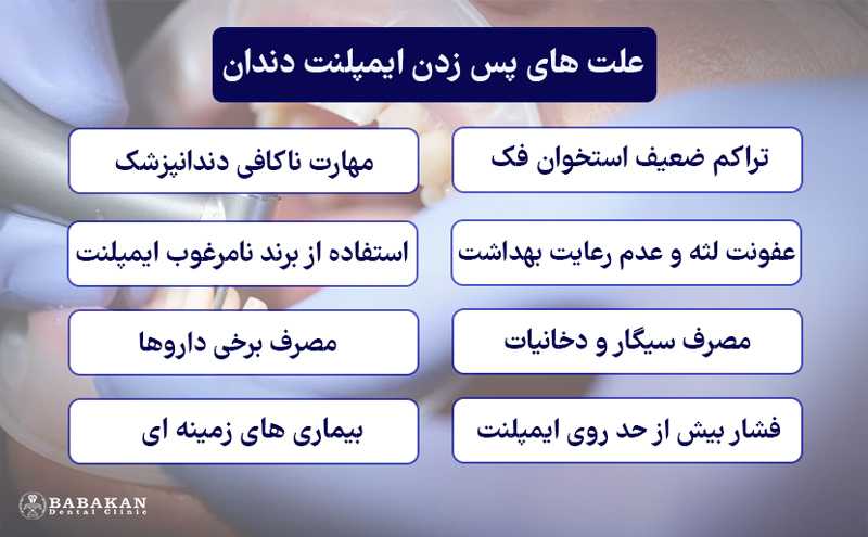 علت پس زدن ایمپلنت