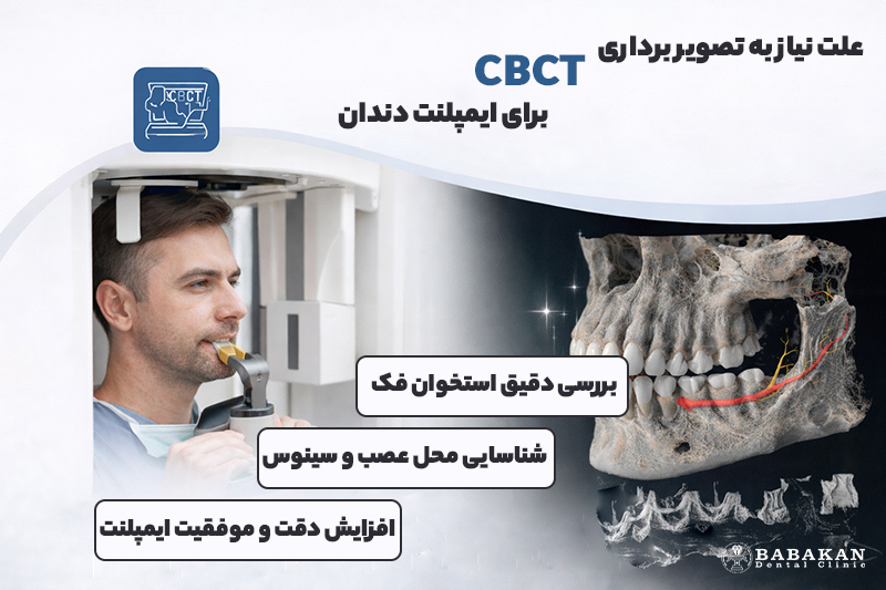 چرا برای ایمپلنت دندان به CBCT نیاز داریم