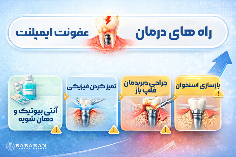درمان عفونت ایمپلنت دندان