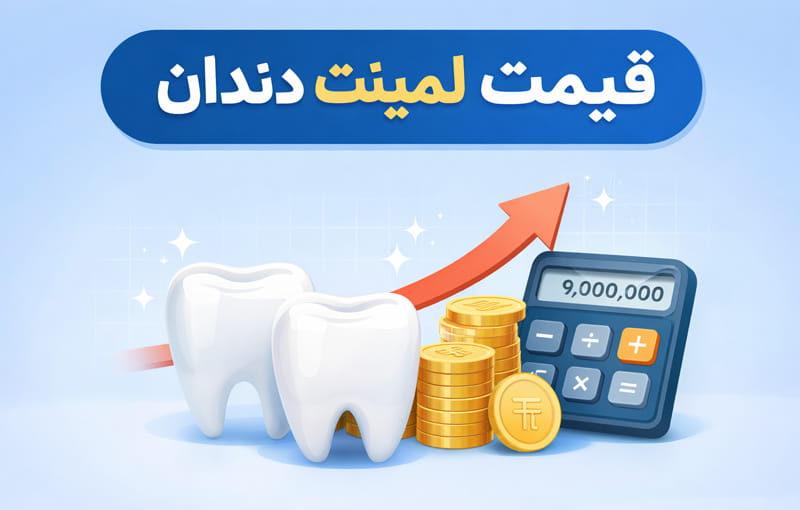 قیمت لمینت دندان