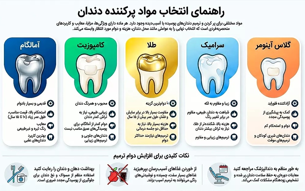 بهترین مواد پرکردن دندان