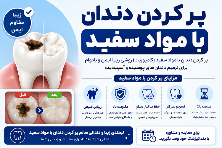 پر کردن دندان با مواد سفید