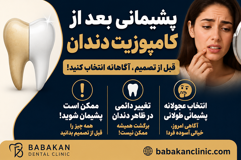 پشیمانی یعد از کامپوزیت